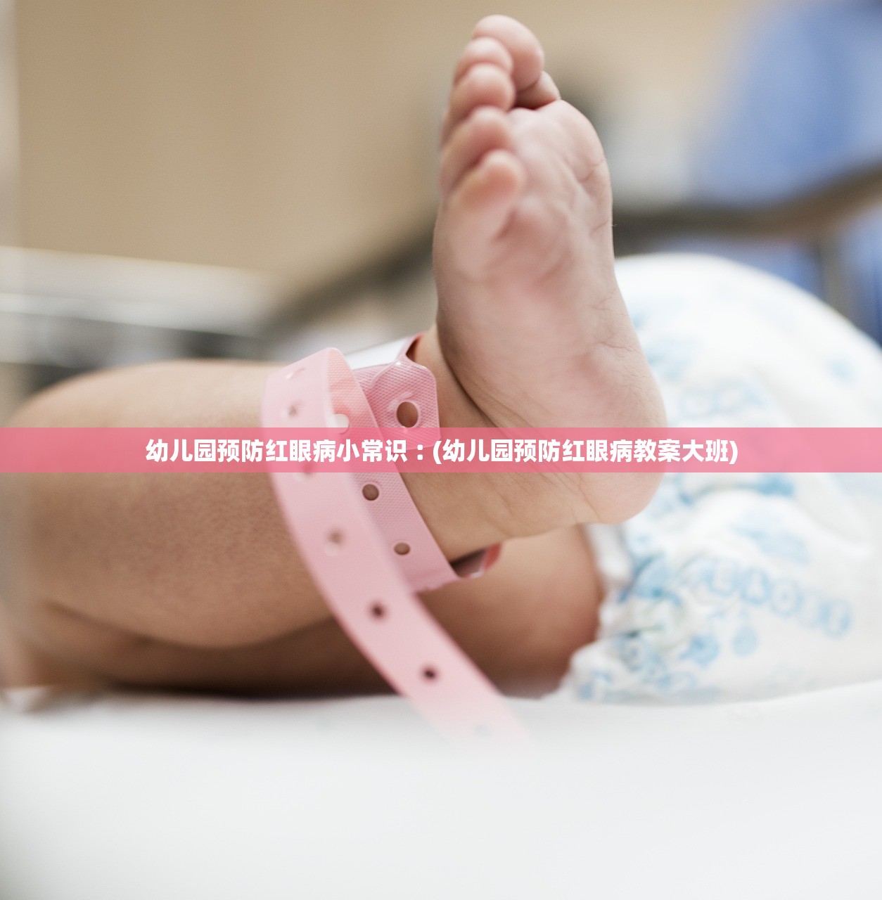 幼儿园预防红眼病小常识︰(幼儿园预防红眼病教案大班)